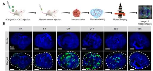 中國科學技術大學王育才教授:納米級聯簇化酶用于腫瘤葡萄糖耗竭治療